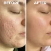 Dual Action Real Deep Collagen Sheets for both wrinkle smoothing and new or old scar fading