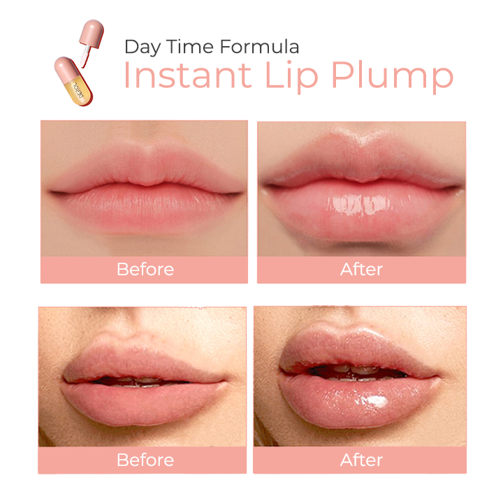 💝DEROL™ Lip Plumper Kit（BUY 2 FREE SHIPPING）