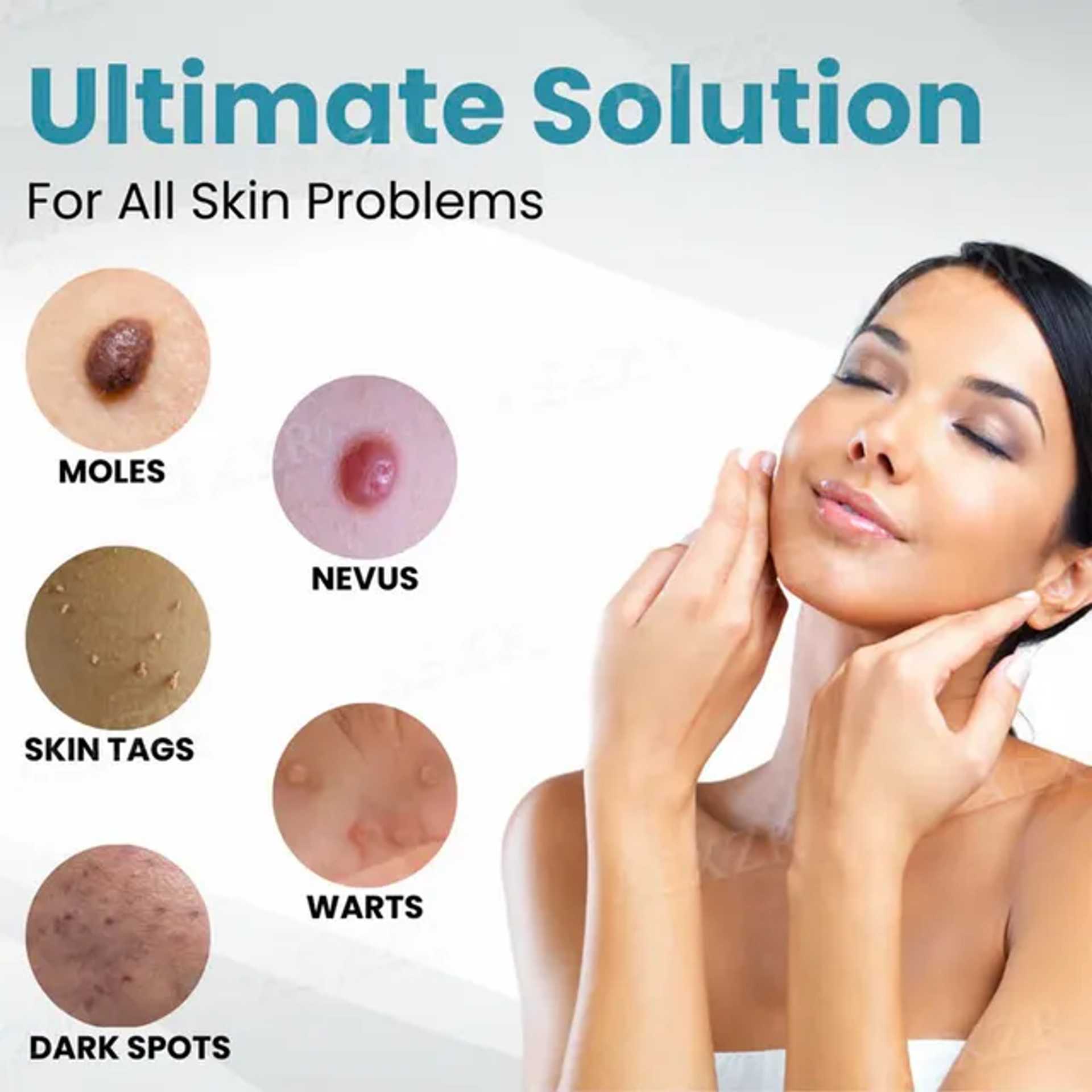 🔥Last Day Promotion 50% OFF💥Non-Invasive Mole and Wart Removal Laser Pen⚡️BUY 2 FREE SHIPPING