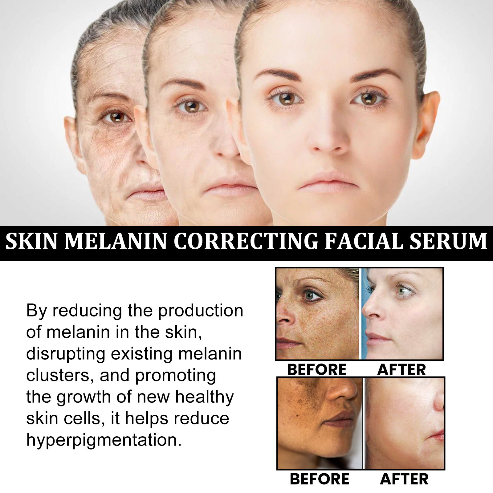 🔥Last Day Promotion 48% OFF-🎁-Melanin Correcting Facial Serum