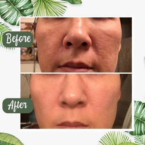 ✨Free shipping-Last Day 75% OFF 🔥-🍵 Deep Cleanse Green Tea Mask
