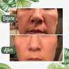 ✨Free shipping-Last Day 75% OFF 🔥-🍵 Deep Cleanse Green Tea Mask