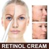 Last Day Promotion 50% OFF -🔥 Retinol Anti Aging Wrinkle Removal Skin Firming Cream🔥