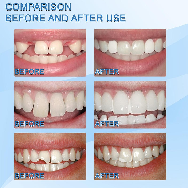 2023 New Year Limited Time Sale 70% OFF🎉Tooth Repair Granules 🔥Buy 2 Get Free Shipping
