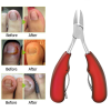(🔥Last Day Promotion- SAVE 48% OFF)Toenail Clipper for Ingrown or Thick Nails(buy 2 get 1 free now)