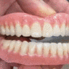 ✨Free shipping-BENDCHARGE™ - Premium Denture