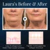 BeautyRest + Anti-Snoring V-Face Beauty Device-BUY 2 FREE SHIPPING