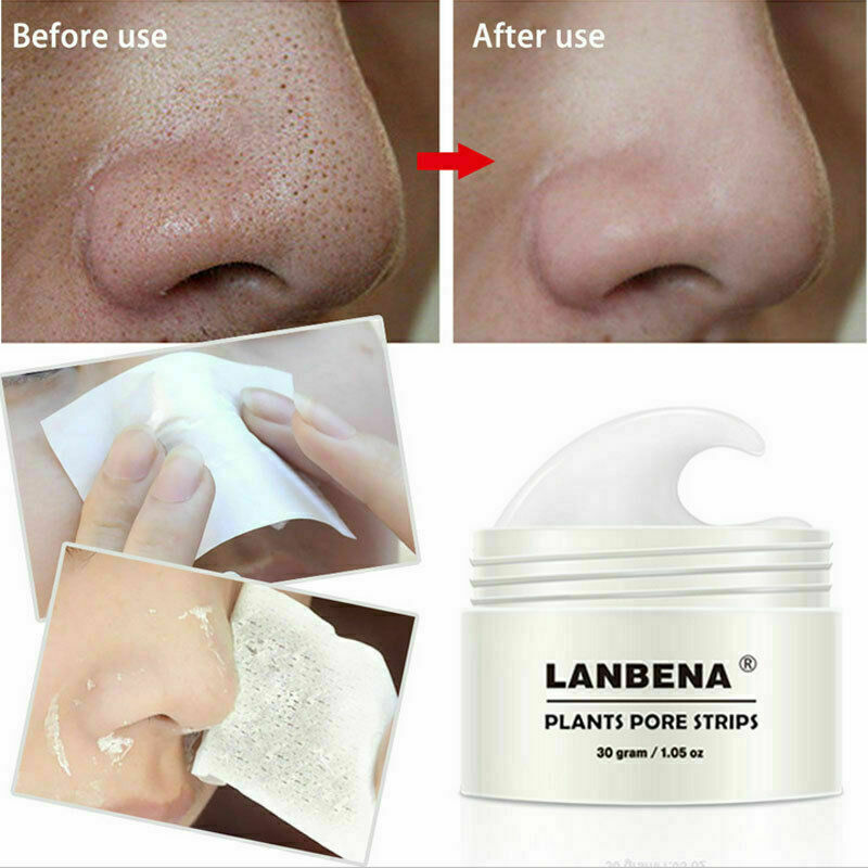 🔥Last Day Promotion 50% OFF🔥Lanbena™ - Nose Plants Pore Strips