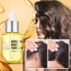 🔥Last Day 70% OFF - PURC Hair Growth Essential Oil