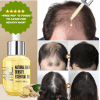 PURC Hair Regrowth Treatment - Anti Hair Loss & Hair Growth