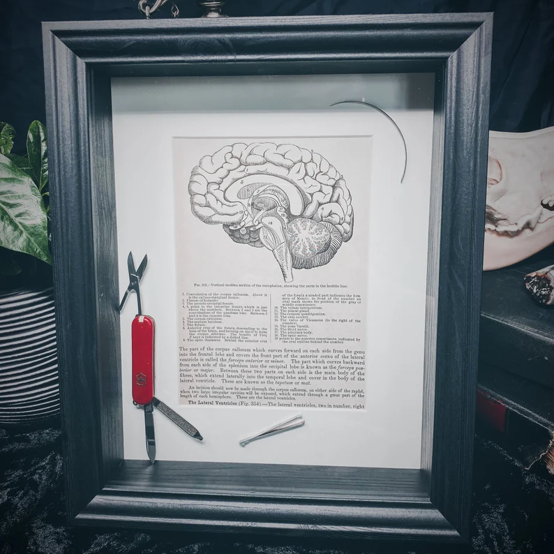 Lobotomy Shadowbox Display