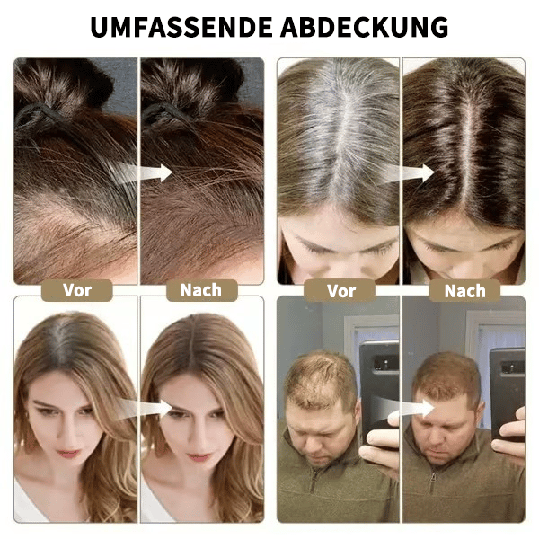 🔥Letzter Tag 49% Rabatt 💕Das perfekte Werkzeug zum Auffüllen des Haaransatzes