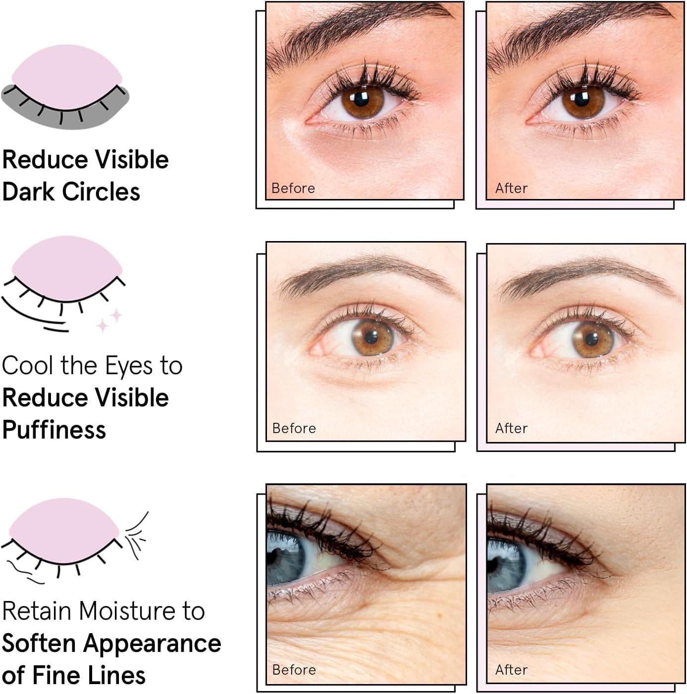 💥LAST DAY SALE 50% OFF💥Eye Bags Gel Eye Mask⚡BUY 2 GET 2 FREE