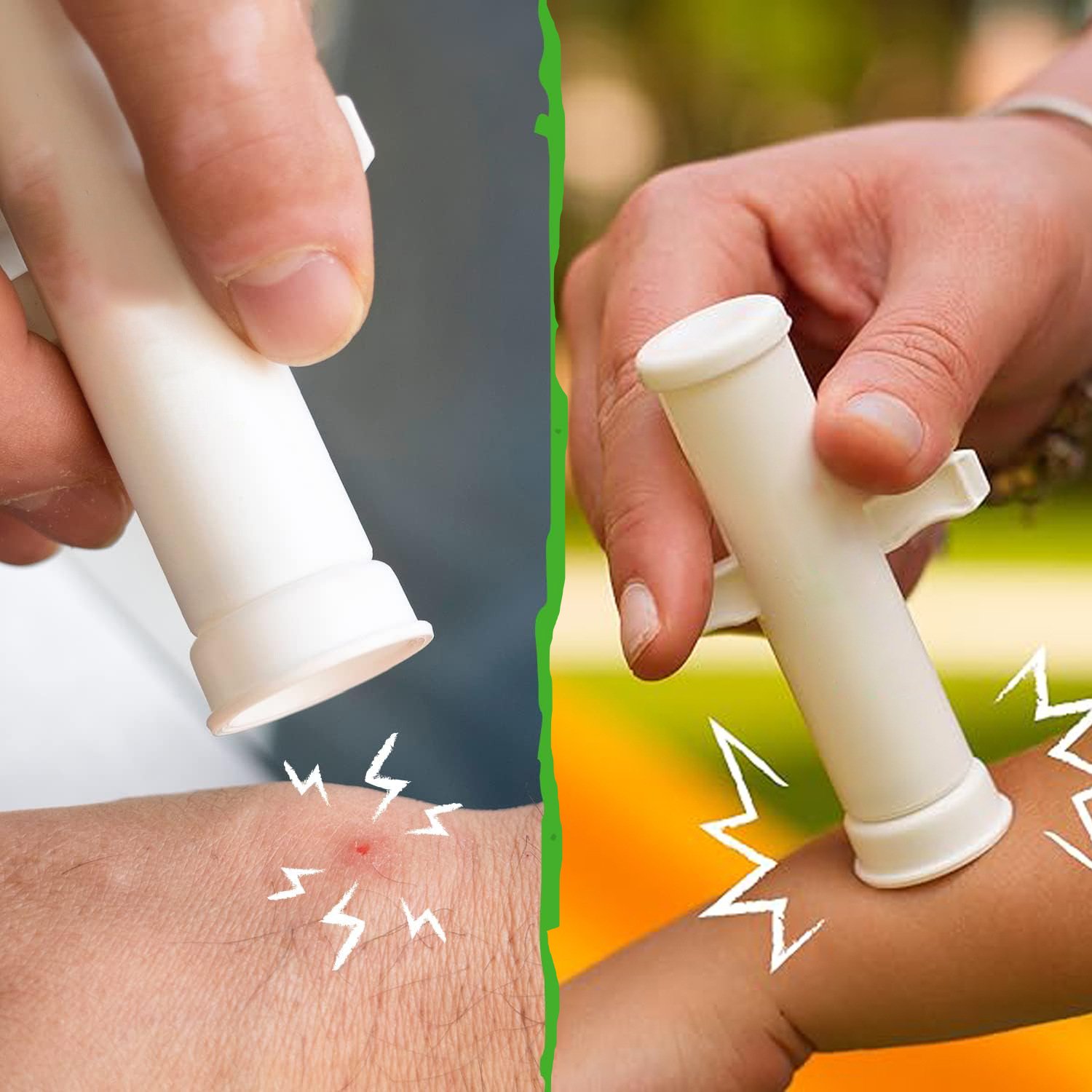 🎁TikTok Last Day Sale - 70% OFF🔥Bug Bite Suction Tool🦟 - Relieve itching and swelling✅