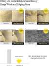 🌟 Buy 1 Get 1 Free🔥The Vita-A Retinal Shot Tightening Booster