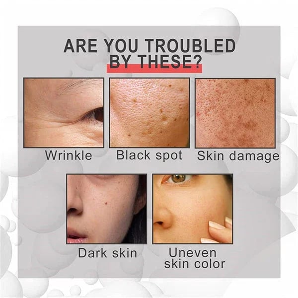 Last Day Promotion 49% OFF--2023 New Collagen Boost Anti-Aging Serum