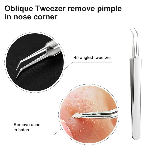 💥LAST DAY SALE 50% OFF💥Professional Facial Blackhead Remover Tweezers