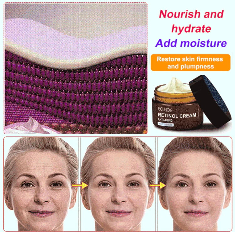 🔥Last Day Promotion 69% OFF🔥Retinol Anti Aging Wrinkle Removal Skin Firming Cream