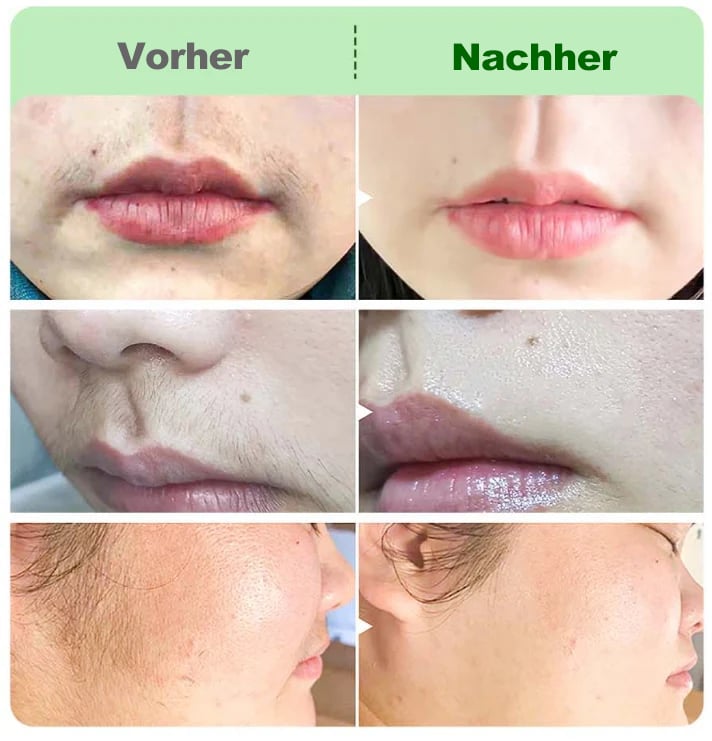 🔥Kaufe 2 Erhalte 1 GRATIS🎁Haarentfernungscreme-Set für Frauen