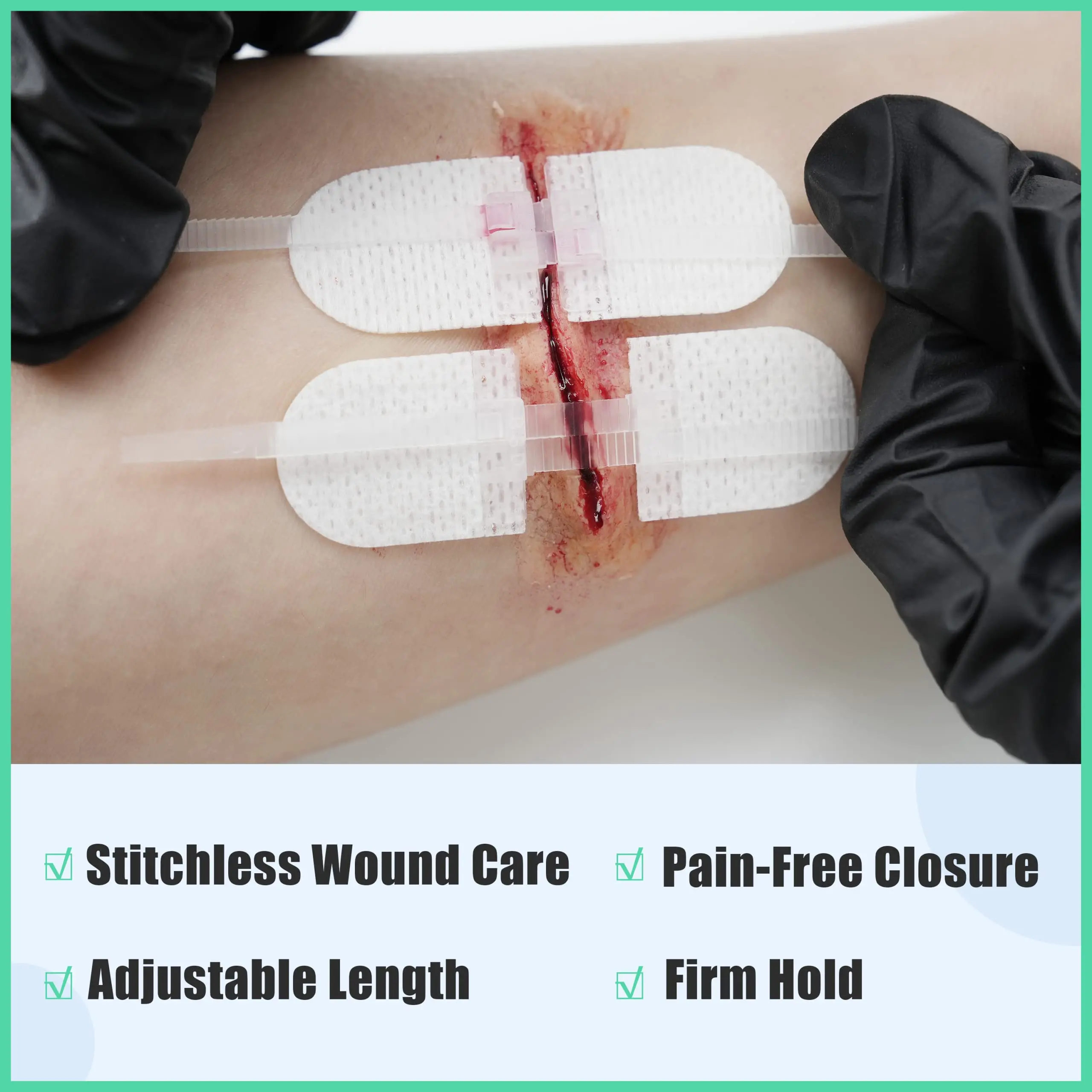 Stitchless Wound Closure Strips