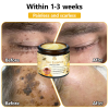 BENDCHARGE™ Bee Essence Skin Treatment Cream (AAD Recommended👨‍⚕️)