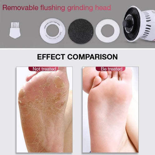 🔥Last Day Promotion 70% OFF🔥Foot Glosser