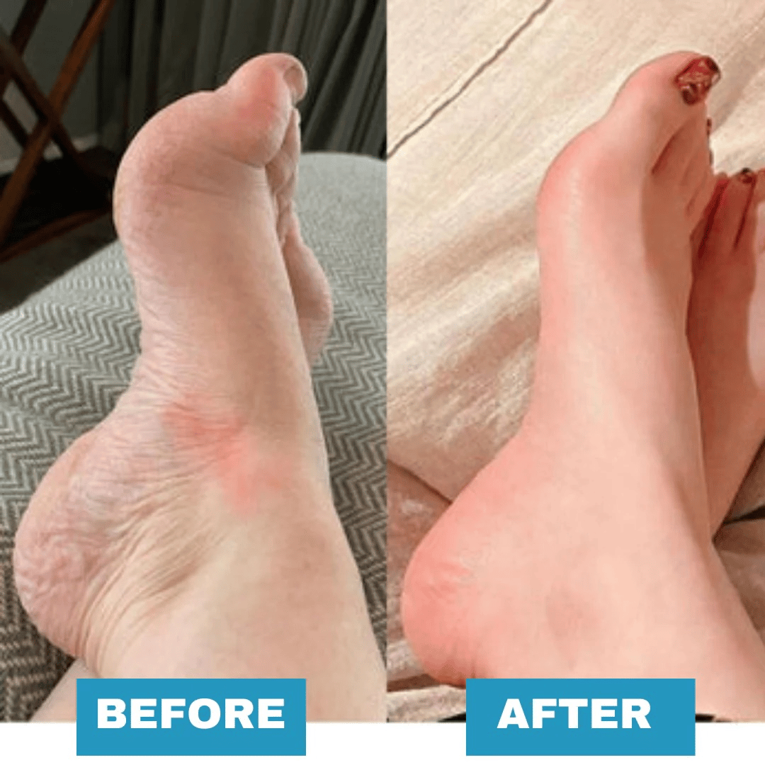 🔥Last Day 49% OFF - Foot Massager - For Lasting Foot Pain Relief