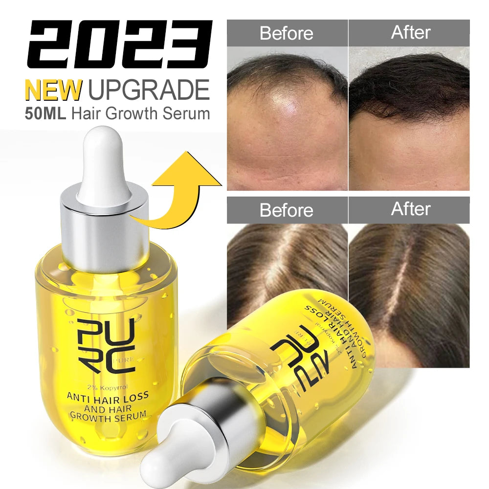 🔥LAST DAY 50% OFF 🔥PURC Hair Regrowth Treatment - Anti Hair Loss & Hair Growth