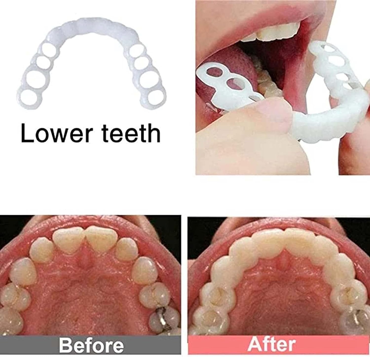 🔥Last Day Promotion 50% OFF-👨‍⚕Adjustable dentures😁