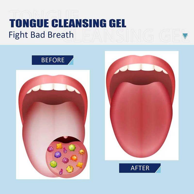 (✨Early Mother's Day Sale - 50% OFF) Tongue Cleaning Gel With Cleaner Brush