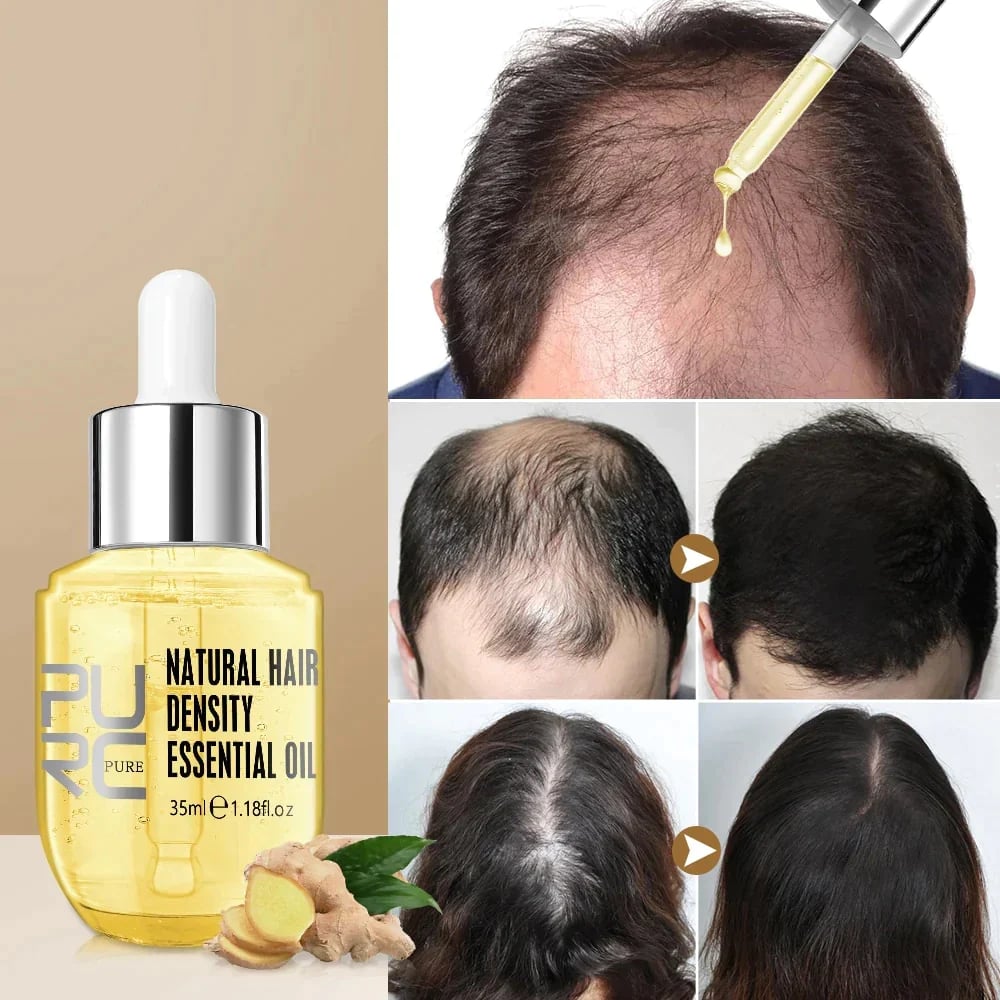 🔥Limited Time Sale 48% OFF🎉Hair Growth Essential Oil - Reclaim Your Luscious Locks!