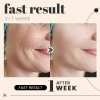 💖Christmas sale 60% OFF🌹Korean Collagen Firming Mask⚡Buy 2 Get 1 Free (3 Pcs)