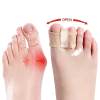 ⏰LAST DAY SALE 50% OFF💥Premium Elastic Toe Separators – Comfortable Pain Relief & Alignment