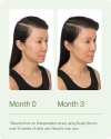 ✨LAST DAY ONLY 50% OFF🍃Divi Scalp Serum