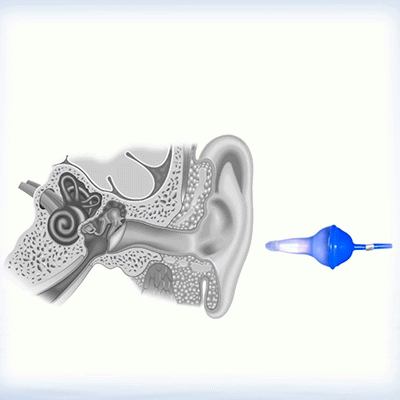 🔥Innovative Inflatable Earplugs