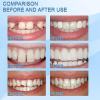 (🎁LAST DAY 70% OFF)🔥Tooth Repair Granules
