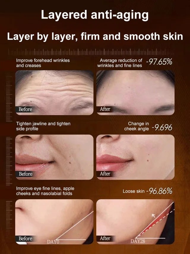 🎁TikTok Last Day Sale - 70% OFF🔥Micro-molecular collagen anti-wrinkle lotion [One touch to remove wrinkles]