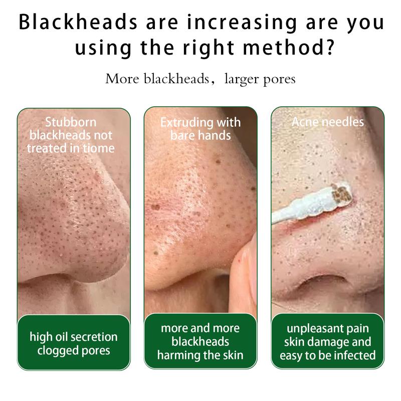 💜 LAST DAY PROMOTION - 50%💜🌿OTEH Blackhead Nose Pore Patches – Deep Cleansing & Oil Control