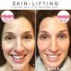 Last Day Promotion 49% OFF - 🔥2023 New Botox Face Serum