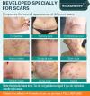 ❤️ScarRemove™ Advanced Scar Spray For All Types of Scars - For example Acne Scars, Surgical Scars and Stretch Marks🔥