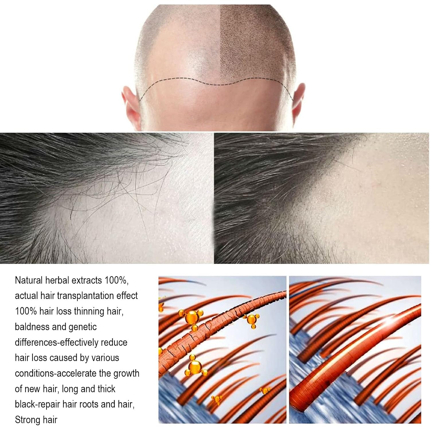 Microneedle Hair Regrowth System Hair Thickening Solution