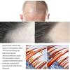 Microneedle Hair Regrowth System Hair Thickening Solution