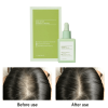 ✨LAST DAY ONLY 50% OFF🍃Divi Scalp Serum