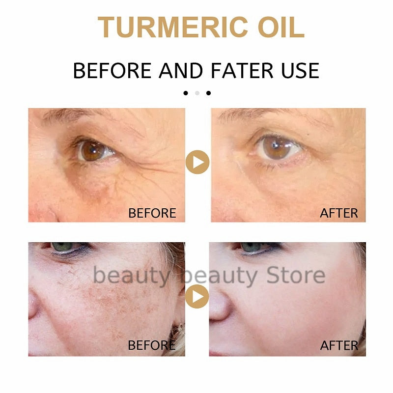 🔥2023 HOT SLAE🎁-Turmeric Spot Correcting Serum