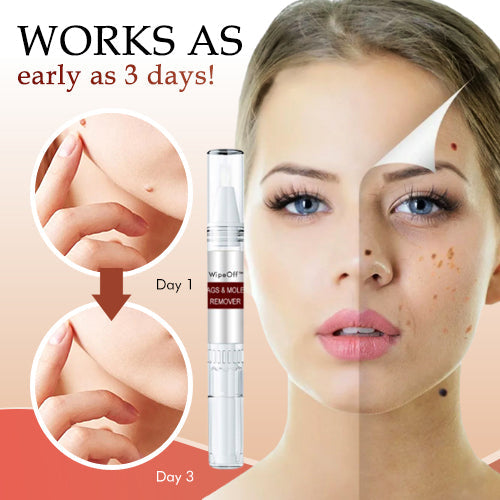 🔥Last Day Promotion 65% OFF🔥Tags & Moles Remover