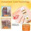🔥Last Day Promotion 70% OFF💥Cvreoz® Bee Venom Nail Renewal Spray