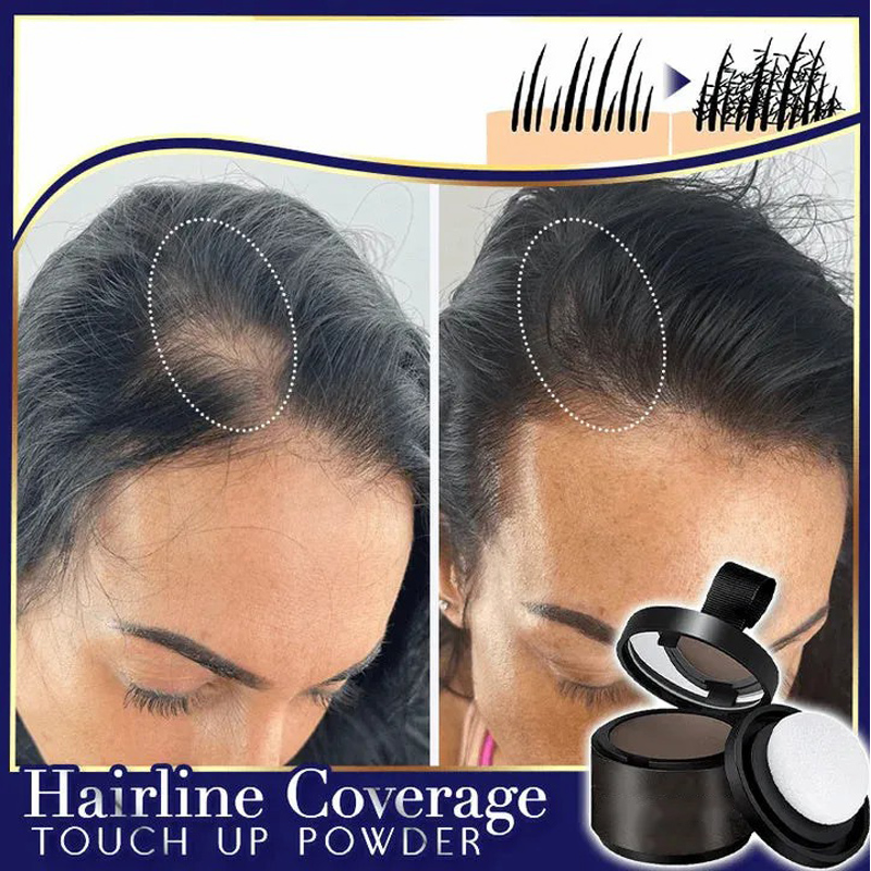 🎉Buy One Get One Free🎁 - Premium Hairline Coverage Touch Up Powder