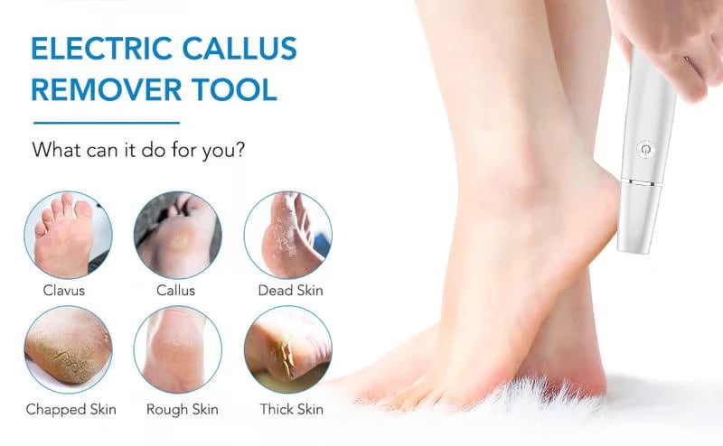 🔥Last Day Promotion 50% OFF💥Electric Feet Callus Remover