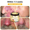 BENDCHARGE™ Bee Essence Skin Treatment Cream (AAD Recommended👨‍⚕️)