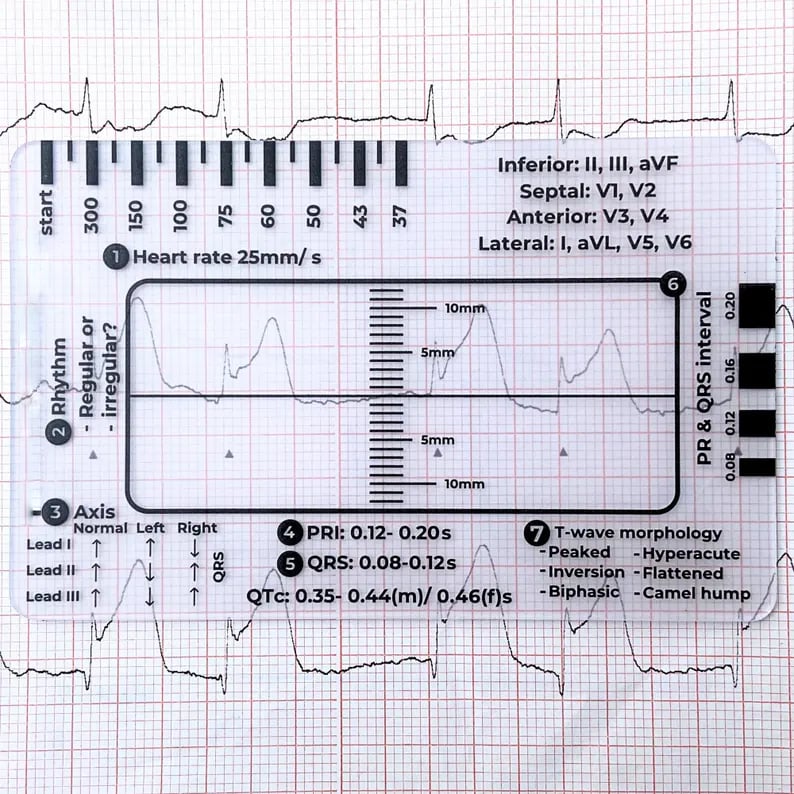 (🌲Early Christmas Sale- 49% OFF) ECG 7 Step Ruler - ECG Assessment Tool